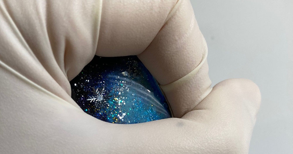 星空のように美しい義眼を特注してみた 義眼に込められた思いにはっとさせられる 1 2 ページ ねとらぼ