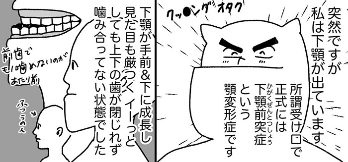 このまま自分を気に入らないまま人生終わらせたくない 長年悩んだ 受け口 の治療に踏み切った実録漫画 1 2 ページ ねとらぼ
