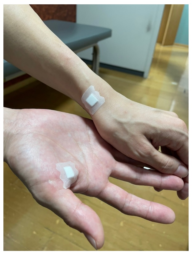 スマホ持つのも痛い 時東ぁみ ドケルバン病 ばね指悪化で日常生活に制限 両手の痛みを 我慢できず注射 1 2 ページ ねとらぼ