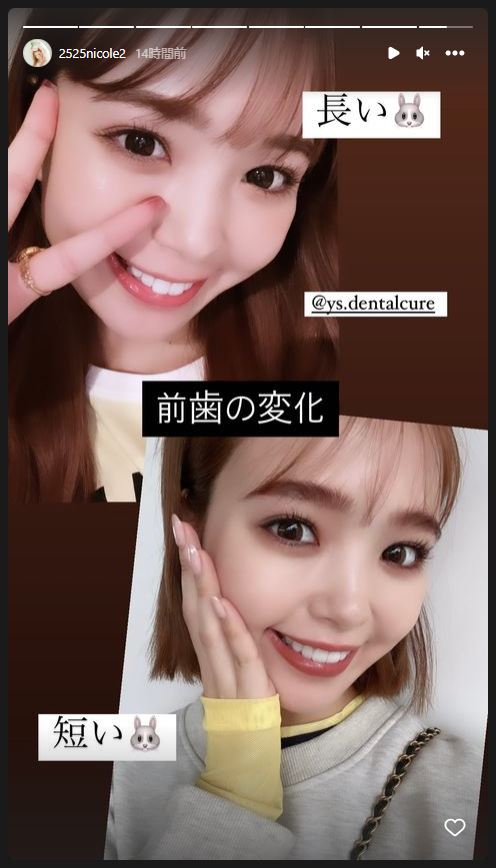 やっとワーって笑える 藤田ニコル セラミック矯正完了で完璧な歯ならびゲット レタッチ不要の口元に 大満足 1 2 ページ ねとらぼ