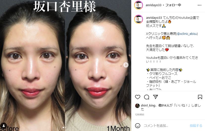Before After 画像 – 疑似要素に画像を表示 : 写真比較！無料のおすすめビフォーアフターアプリ6選 – XTGO