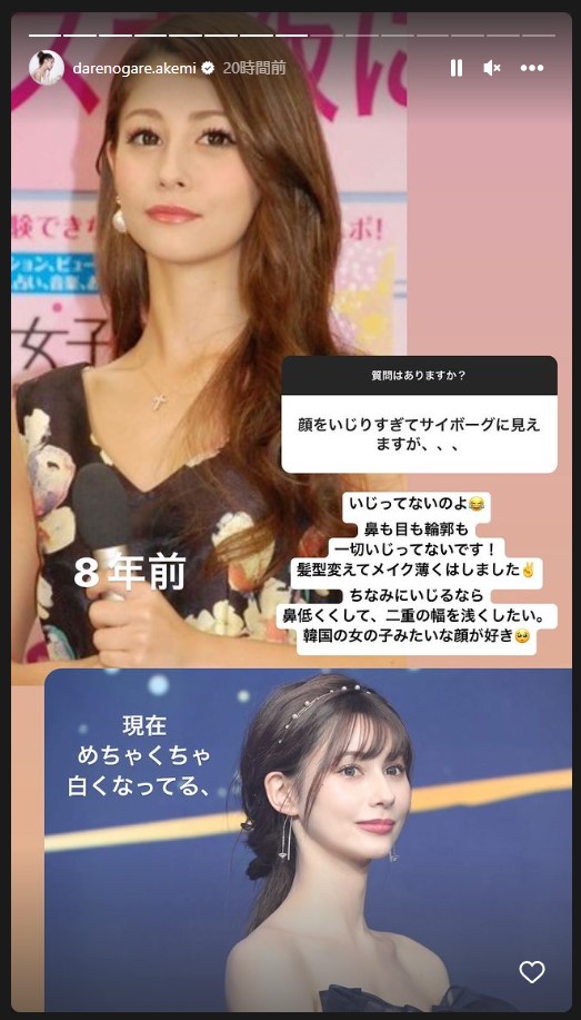 「顔イジりすぎ」「サイボーグ」 ダレノガレ明美、8年前との“比較ショット”で整形疑惑をバッサリ (l ...