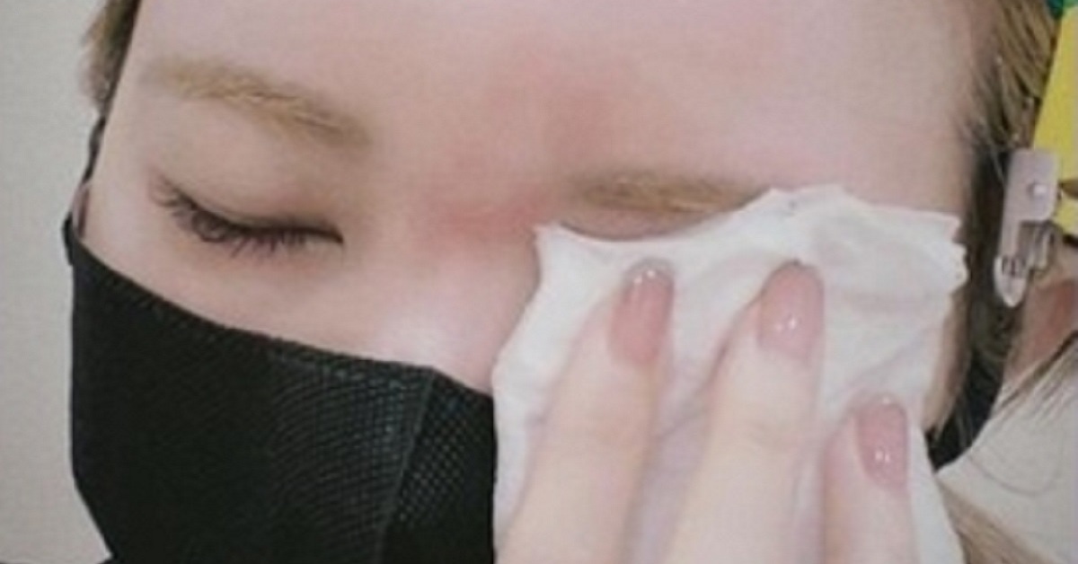 小児における帯状疱疹の潜在的な合併症