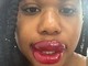 フォロワー17万人のTikToker、“唇タトゥー”失敗動画が大バズり　ネットの過剰反応に反論「私の唇だよ？」