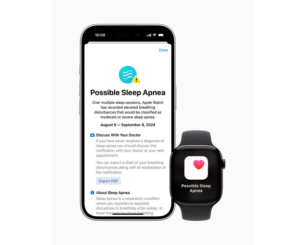Apple Watch Series 10 10TN X}[gEHb` Apple `^jE A~jE