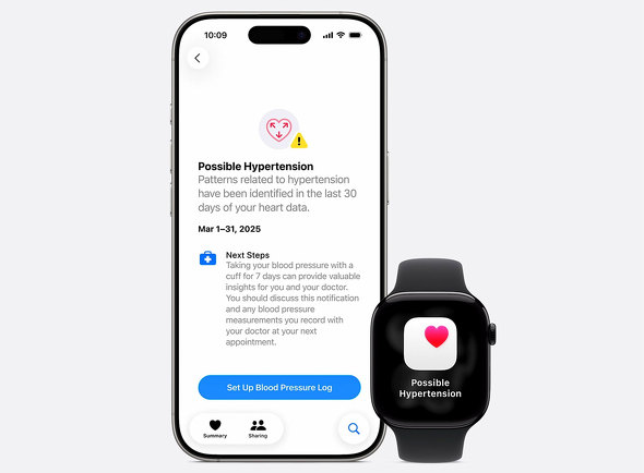 Apple Apple Watch Series 11 Ultra SE 3 X}[gEHb`  