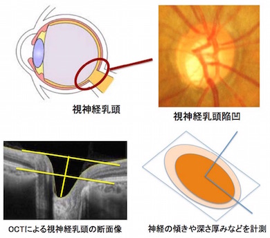 OCTによる視神経乳頭の計測